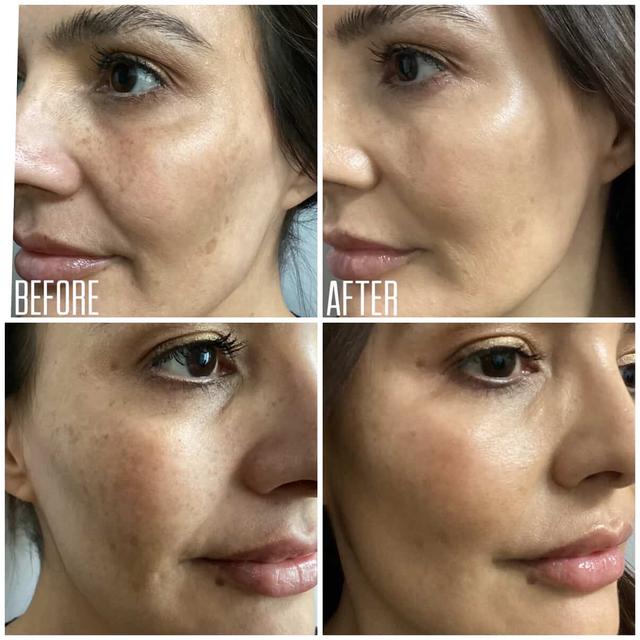 💫 The Better Glow-up